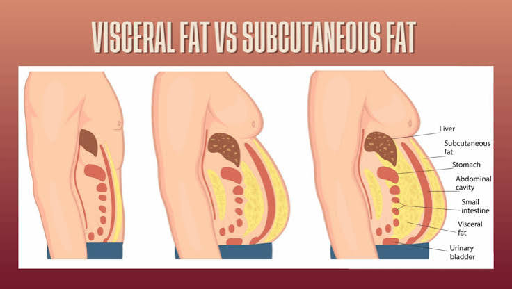 Subcutaneous Fat vs Visceral Fat