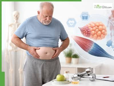Sarcopenic Obesity