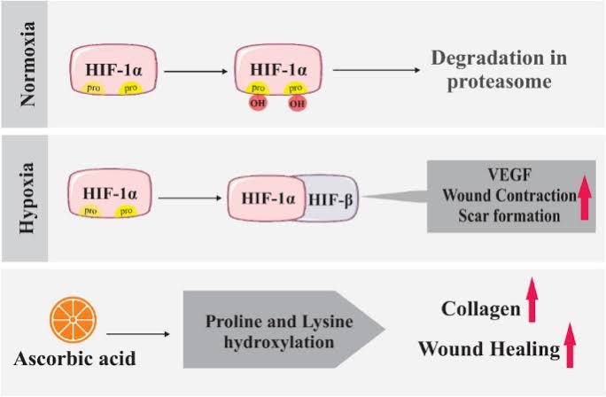 Vitamin C and wound healing