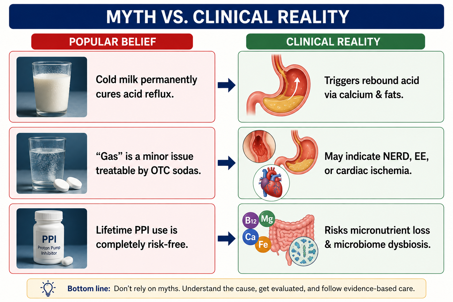 Common Myths with GERD at home treatments