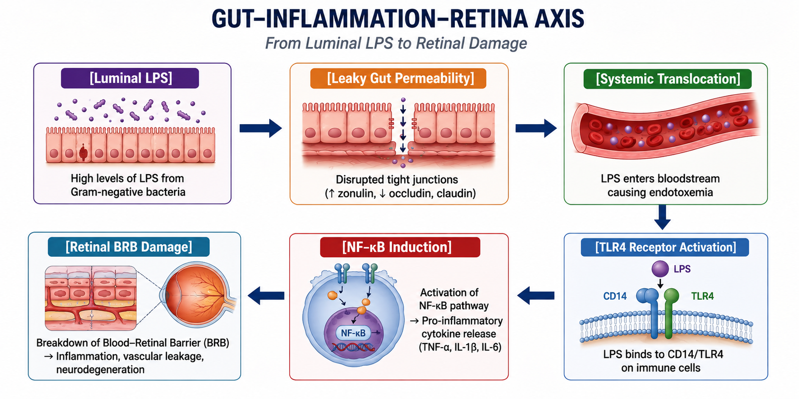 Gut Inflammation and Retinal Damage Relationship